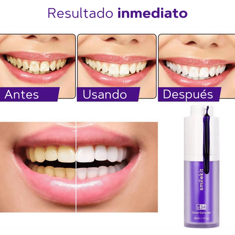 Smilekit® | espuma para blanquear Dientes en 1 minuto