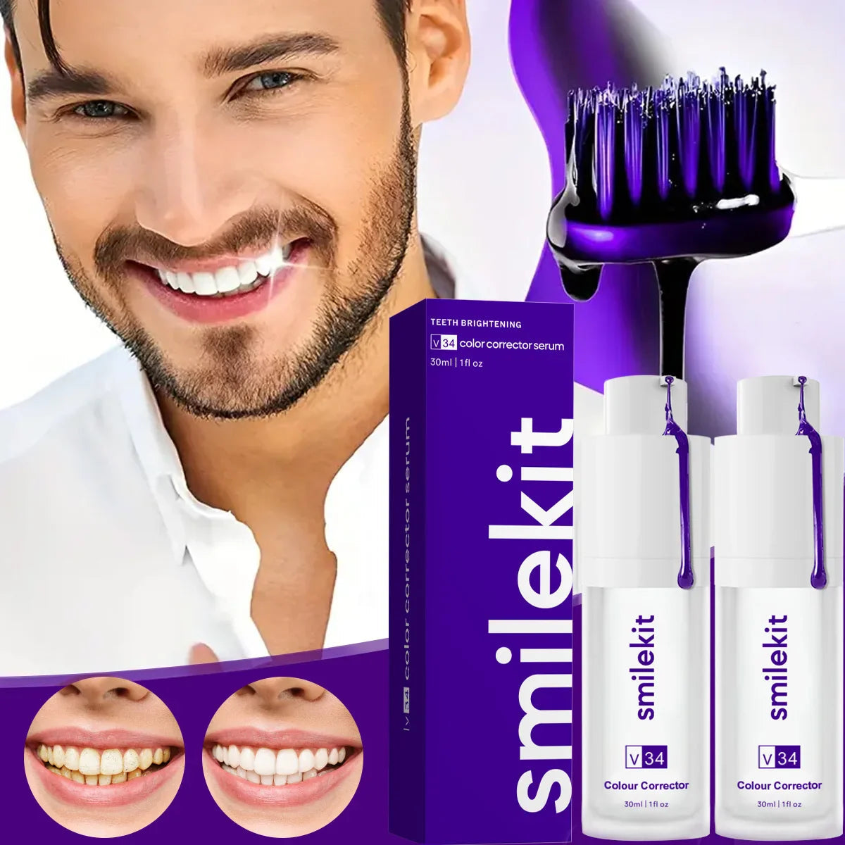 Smilekit® | espuma para blanquear Dientes en 1 minuto