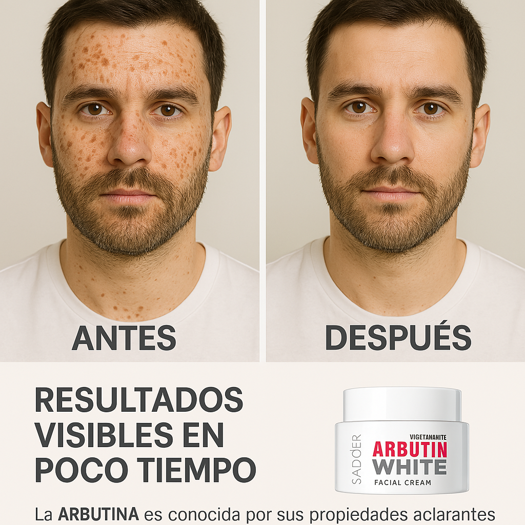 Arbutin White | SADOER® - Crema para quitar manchas y aclarar la piel