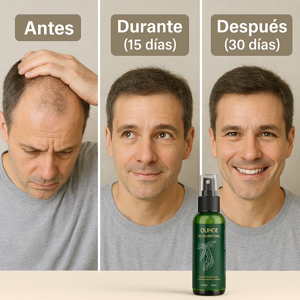 Tonico Para Crecer El Pelo | OUHOE™