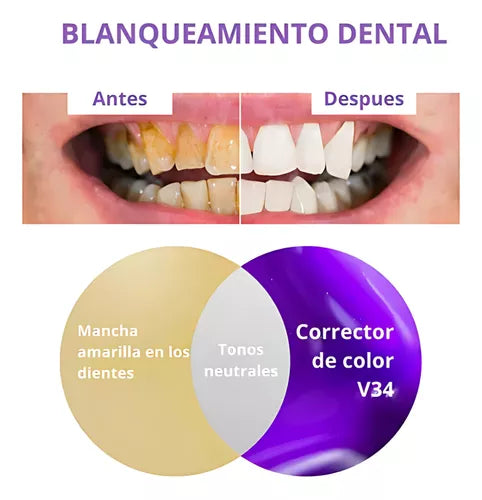 Smilekit® | espuma para blanquear Dientes en 1 minuto
