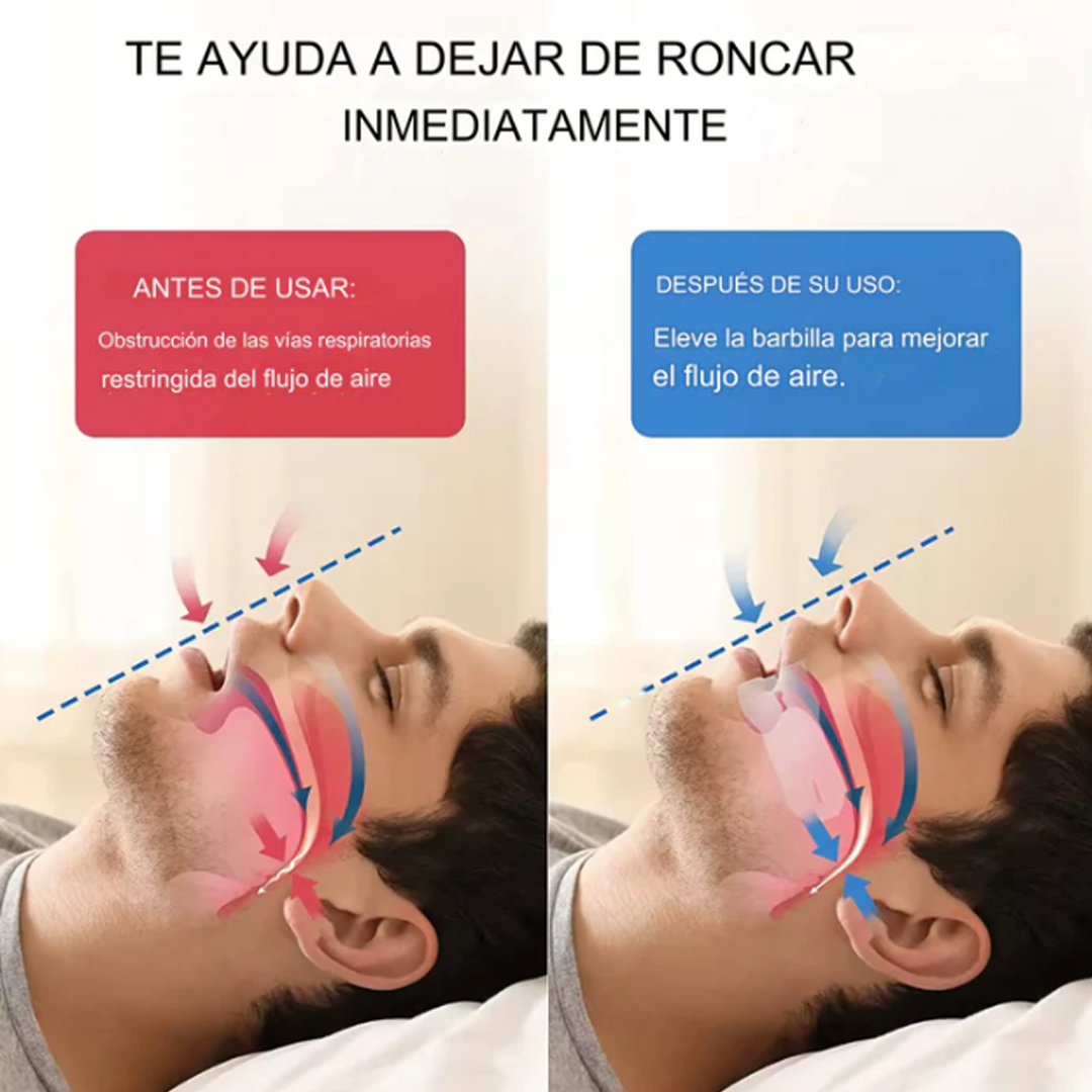PROTECTOR BUCAL™ ANTIRRONQUIDOS / ANTIBRUXISMO / APNEA